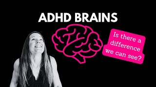 Whats Special about ADHD Brains [upl. by Nerahs]