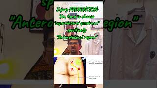 Superior gluteal nerve mbbs anatomy education [upl. by Noj]