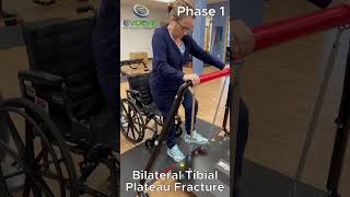 One Critical Exercise to ReLearn How to Walk After Bilateral Tibial Plateau Fractures [upl. by Ahsrats880]