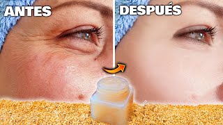 UN MILLÓN de VECES MÁS EFICAZ que el BOTOX  Elimina ARRUGAS y MARCAS de forma NATURAL y CASERA [upl. by Solracnauj576]