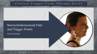 Sternocleidomastoid SCM Pain and Trigger Points [upl. by Okiram]