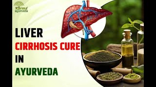 Cirrhosis of Liver Ayurvedic Treatment cirrhosis liver liverdiseaseawareness liverhealth [upl. by Seema]