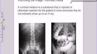 A level Medical Physics  X rays  image intensifiers and contrast media [upl. by Swords658]