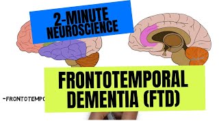 2Minute Neuroscience Frontotemporal Dementia FTD [upl. by Ahsaz]