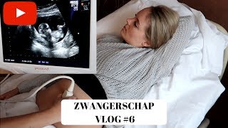 UITSLAG NIPT amp GOEDKOOPSTE BOX OOIT  13 weken  ZWANGERSCHAP VLOG 6 [upl. by Tiffanie801]