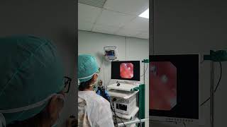 Bronchoscopy or bronkoskopi part 3 [upl. by Shandy374]