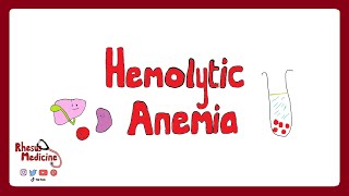 HEMOLYTIC ANEMIA Extravascular v Intravascular Clinical Features Diagnosis Coombs Test  Rhesus [upl. by Riggall]