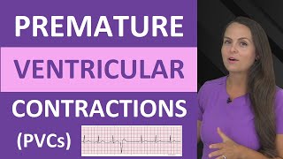 Premature Ventricular Contractions PVCs ECG Nursing NCLEX Bigeminy Trigeminy [upl. by Namso450]