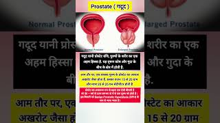 Benign prostatic hyperplasia prostate healthfacts medicalfacts medical medicalcondition health [upl. by Yeldar]