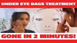 I tried quotThisquot Under Eye Bags Treatment That Works in 2 Minutes [upl. by Man542]