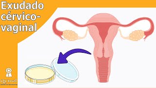 Cultivo cérvico  vaginal TOMA DE MUESTRA y patógenos [upl. by Billye]