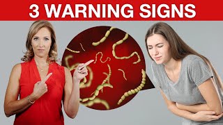 3 Early Warning Signs You Have Parasites 🐛  Dr Janine [upl. by Marianne]