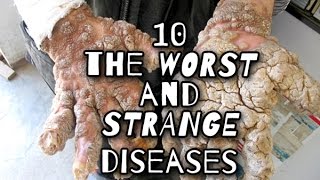 TOP 10 strangest and rare diseases that affected people around the world [upl. by Akkeber]