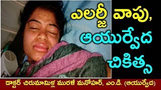 ఎలర్జీ వాపు ఆయుర్వేద చికిత్స  Angioedema allergic swelling and ayurvedic treatment in Telugu [upl. by Caldeira553]