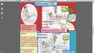 SESSIONS for NURSES 10  CARDIOGENIC AND SEPTIC SHOCK [upl. by Saw]