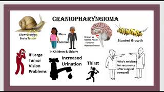 3 Minutes Tumeur Hypophysaire Craniopharyngiome Insuffisance hypophysaire Chirurgie Endoscopique [upl. by Batsheva776]