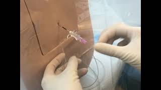 Neuraxial Task Trainer Demonstration  Epidural Anesthesia [upl. by Ecilegna]