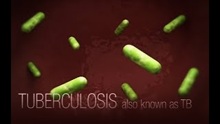 CDC Tuberculosis TB Transmission and Pathogenesis Video [upl. by Ibib502]