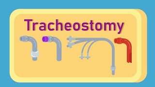 What is Tracheostomy [upl. by Sheff]