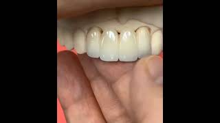 Zirconia Crowns Dental Lab from Chinadentist dentalprosthetics dentist dentures satisfying [upl. by Anoy]