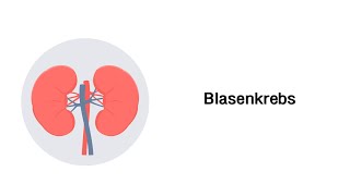 Blasenkrebs Blasenkarzinom  Erkrankungen der Niere und ableitenden Harnwegen [upl. by Harmaning961]