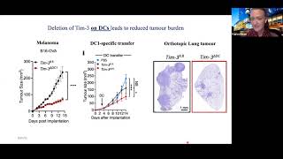 Karen Dixon TIM3 restrains antitumour immunity by regulating inflammasome activation [upl. by Retlaw]