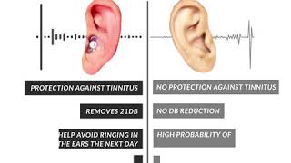 Benefits of WEARING EARPLUGS VS NOT WEARING [upl. by Remled335]