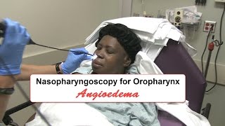 Emergency Nasopharyngoscopy for Angioedema Evaluation [upl. by Nyret643]