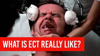 Electroconvulsive Therapy  ECT  What is it REALLY like [upl. by Naed]