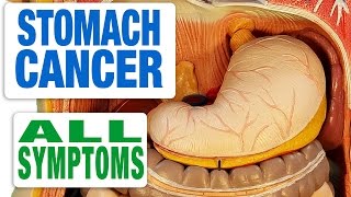 Stomach Cancer  All Symptoms [upl. by Wat]