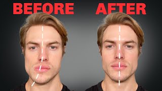 How to Fix Asymmetrical Jaw amp Face FOREVER [upl. by Adnorrahs903]