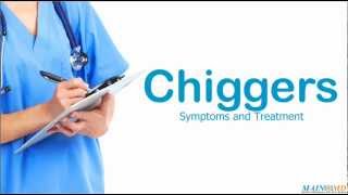 Chiggers Symptoms and Treatment [upl. by Weinert550]