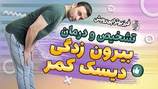 تشخیص دیسک کمر و بیرون زدگی دیسک  فتق  و درمان آن با روش های خانگی [upl. by Dazraf]