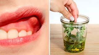 Heal Your Tooth Abscess  Dental Infection Naturally [upl. by Flint]