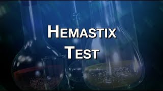 Hemastix Test [upl. by Irwinn]