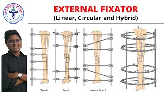 External Fixator  Lecture 07  Orthopedics [upl. by Kciv]