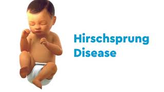 Hirschsprung disease Diagnosis treatment and preventing fecal incontinence [upl. by Allekim]