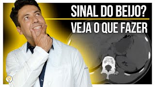 Como diagnosticar HEPATOESPLENOMEGALIA  Método para medir o fígado [upl. by Channing]