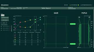 78 BulbiCAM Smooth Vergence test explanation [upl. by Apur]