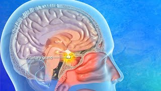 Endoscopic Transsphenoidal Pituitary Surgery Explained [upl. by Dnomde]