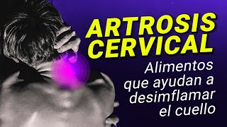 Cómo aliviar el dolor de cuello consejos y tratamientos efectivos [upl. by Kruter63]