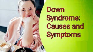 Downs Syndrome Causes and Symptoms [upl. by Meraree]