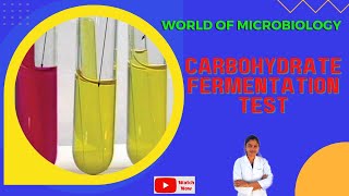 Carbohydrate Fermentation Test Tamil  Identification of Bacteria by Biochemical Test [upl. by Odlanyar]