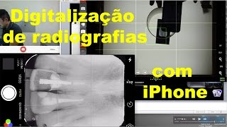 Digitalização de Radiografias  Parte 1 [upl. by Kralc]