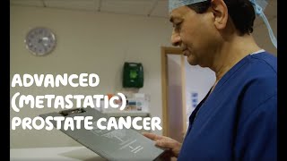 About Advanced Metastatic Prostate Cancer [upl. by Nesyrb]