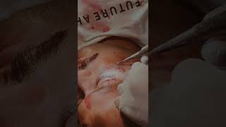 ophthalmology 👁️ gyan youtubeshort youtubevideo trendingshorts [upl. by Nitin584]