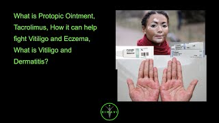 What is Protopic Ointment Tacrolimus How it can help fight Vitiligo and Eczema What is Vitilig [upl. by Cal997]