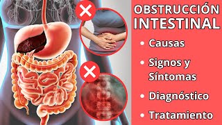 OBSTRUCCIÓN INTESTINAL  Causas signos y síntomas diagnóstico y tratamiento [upl. by Herrington]