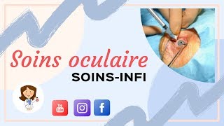 soins oculaire  soins infirmiers  ophtalmologie [upl. by Malcah]