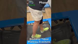 Tibial Rotations  internal and external rotation [upl. by Ahsila832]